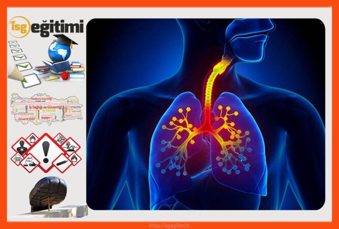 Meslek Hastalıkları